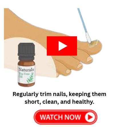 Biblical Cure for Toenail Fungus - 3