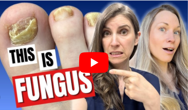 Colloidal Silver for Toenail Fungus