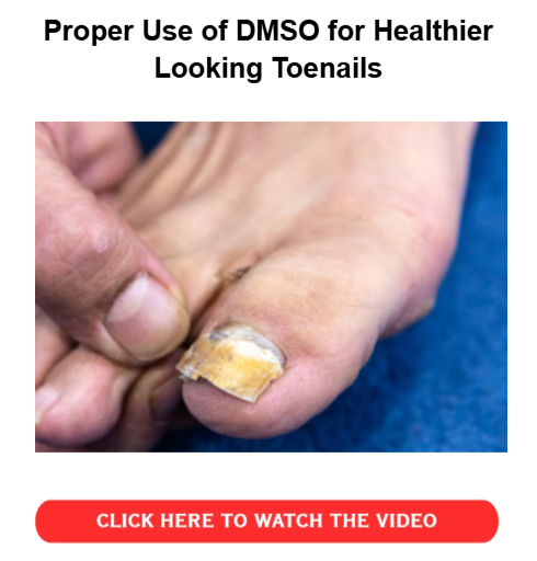 DMSO for Toenail Fungus - Proper Use