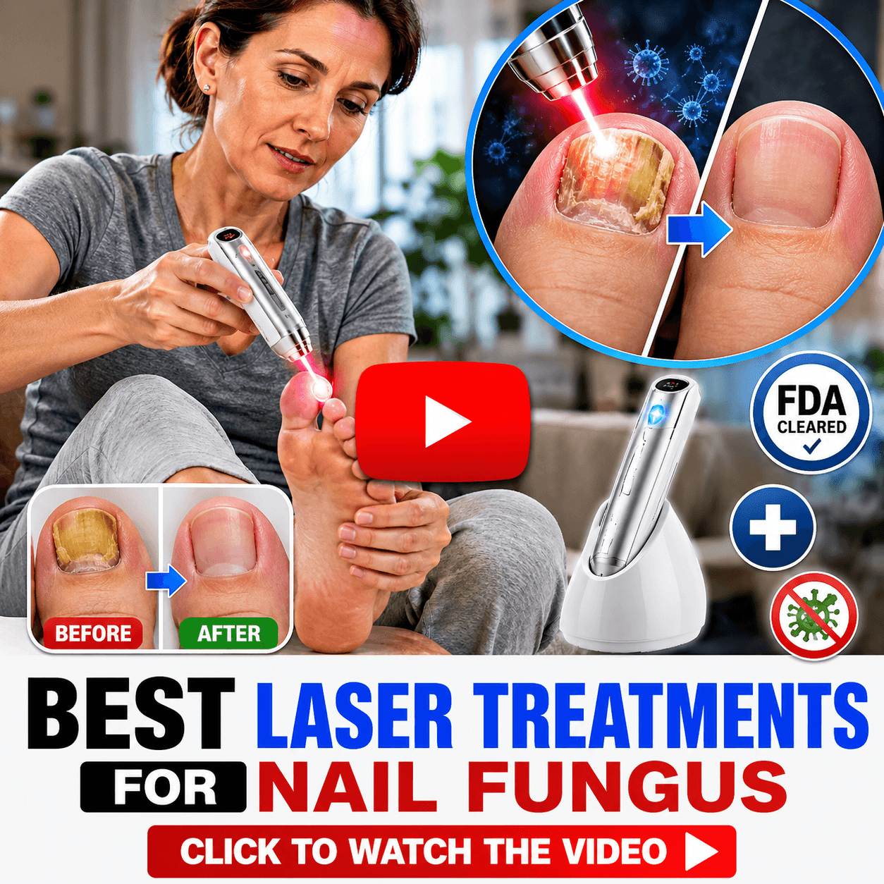 10 Best Laser Devices to Treat Nail Fungus at Home list