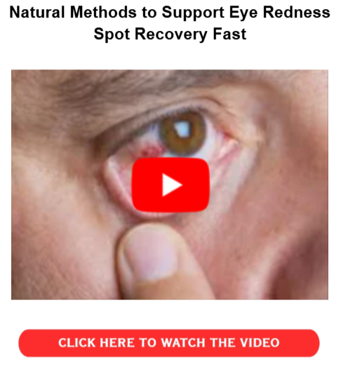 How to Heal a Broken Blood Vessel in the Eye Fast - Support Eye Red