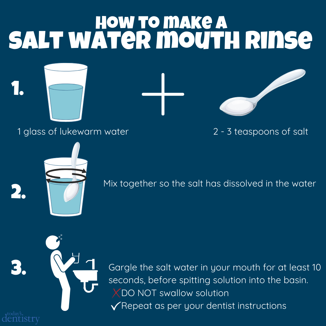Is Salt Water Good for Periodontal Disease --salt-water-mouth-rinse-steps