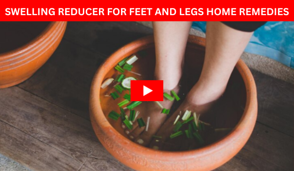 Swelling Reducer for Feet and Legs Home Remedies