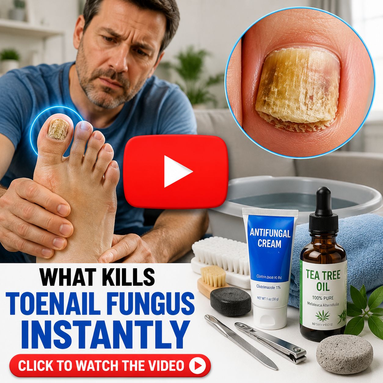Toenail Fungus Instantly 1
