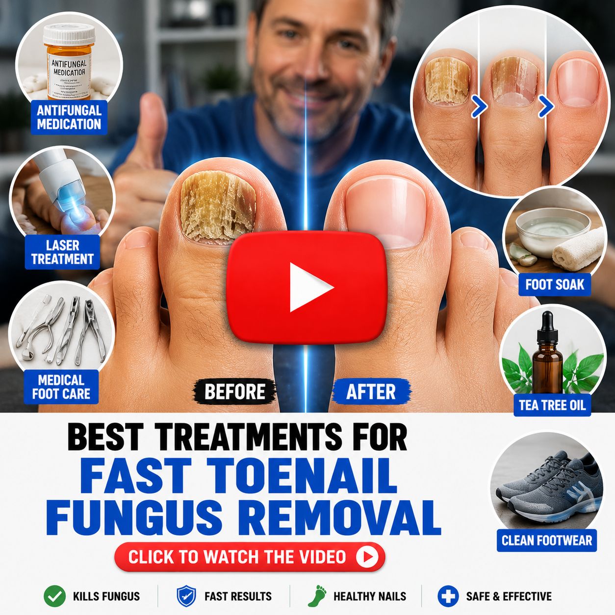 Toenail Fungus Instantly 4