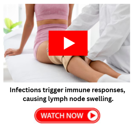 Why Lymph Nodes Swell in Feet and Legs 1