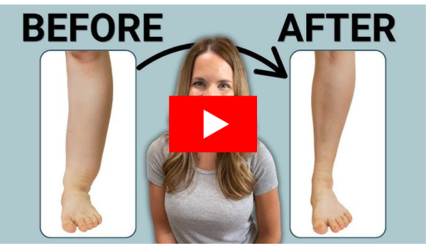 Why Lymph Nodes Swell in Feet and Legs