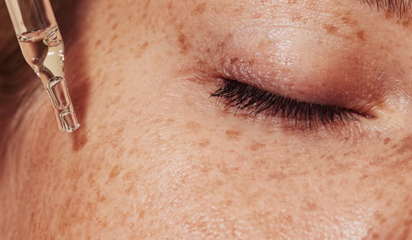 20 Best Hyperpigmentation Products of 2025 (1)