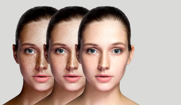 20 Best Hyperpigmentation Products of 2025 (3)