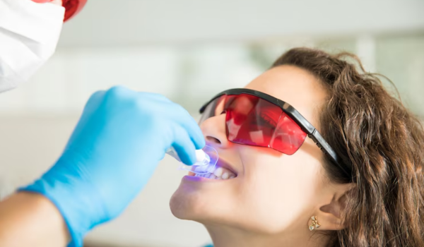 Hydrogen Peroxide for Teeth Whitening (2)