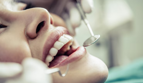 Hydrogen Peroxide for Teeth Whitening