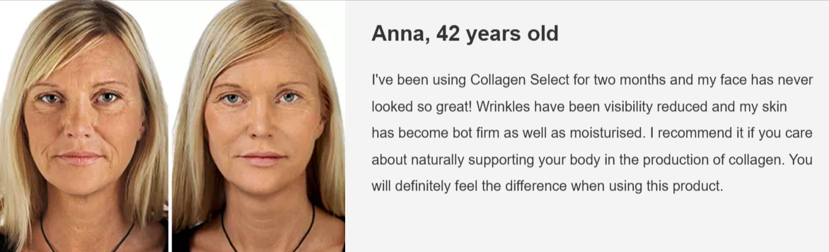 Collagen Select Customer Reviews