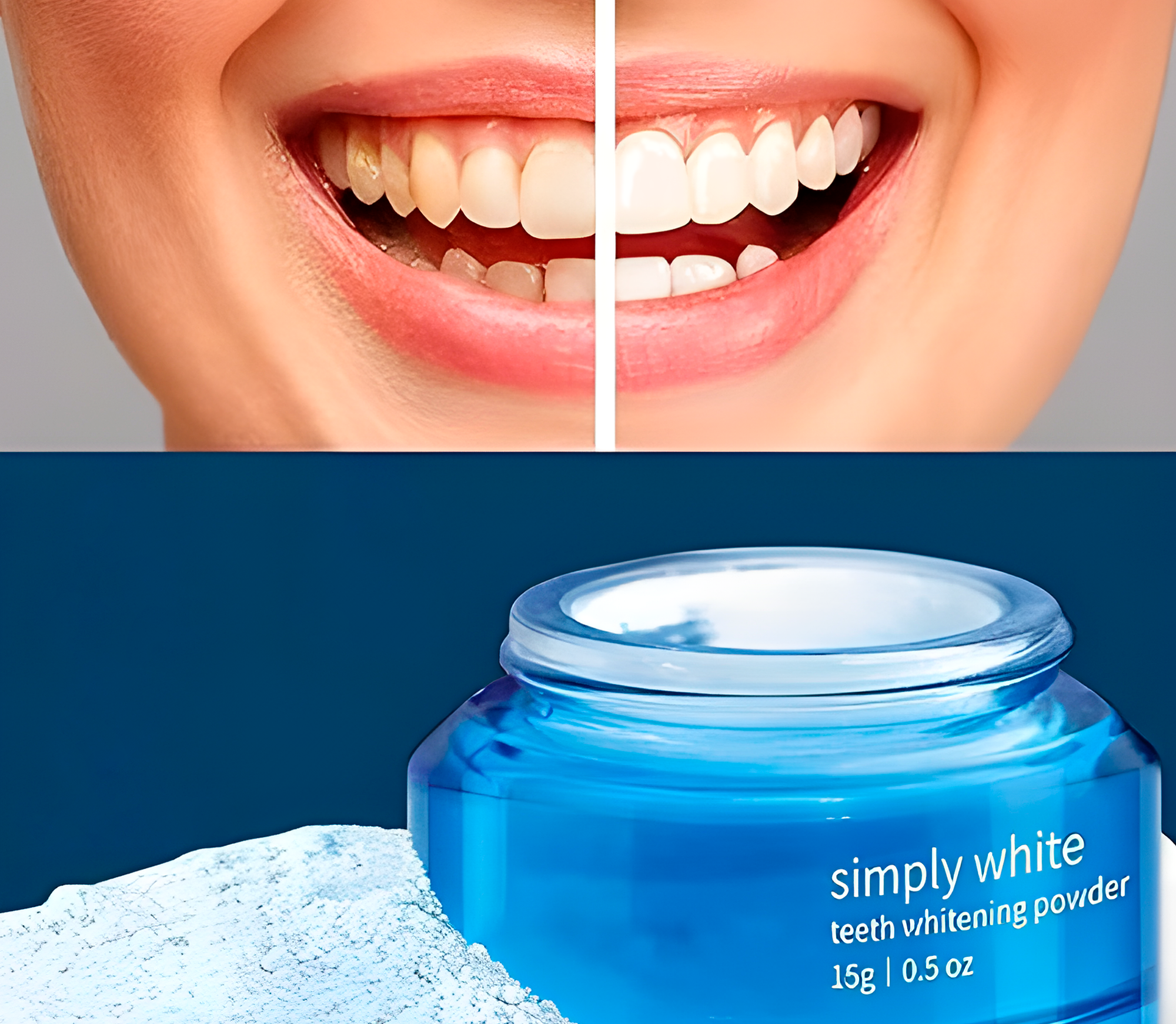 PurelyWHITE DELUXE Teeth Whitening Kit Benefits