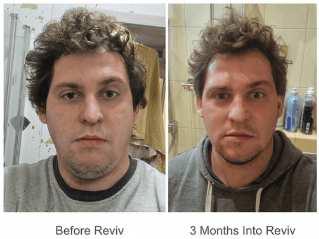 Reviv MouthGuard Benefits