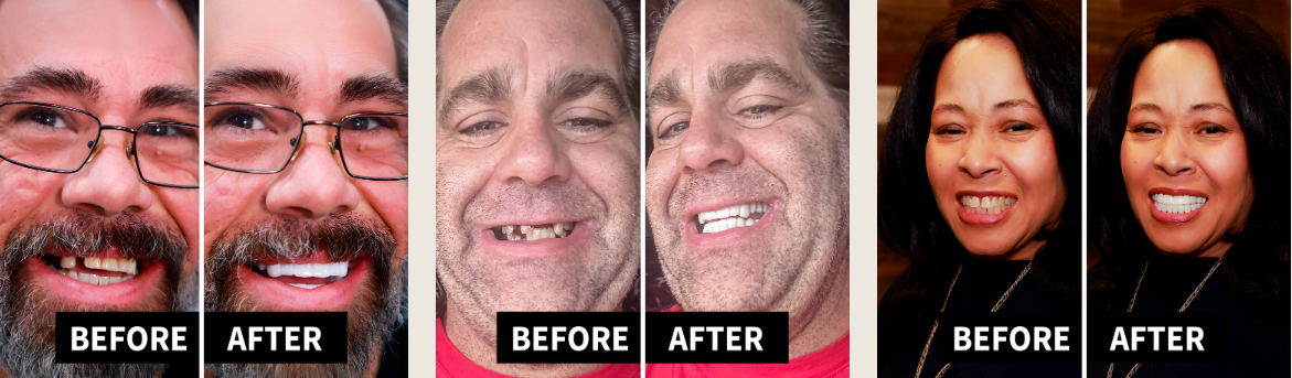 Shiny Smile Veneers Customer Reviews