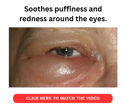 Soothes puffiness and redness around the eyes