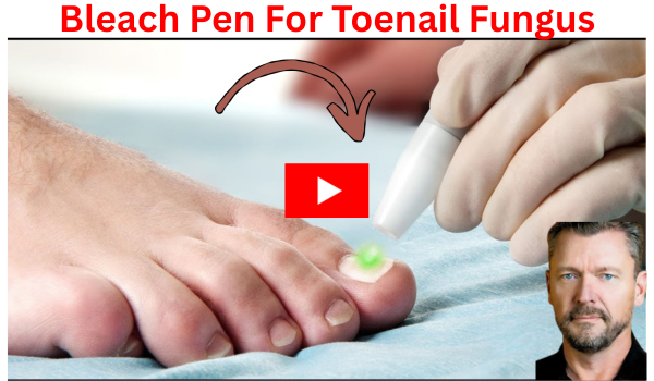 Bleach Pen for Toenail Fungus