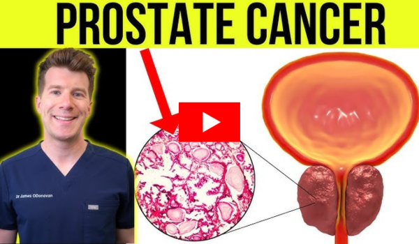 Lupron for prostate cancer