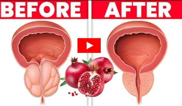 Pomegranate Trick for Prostate