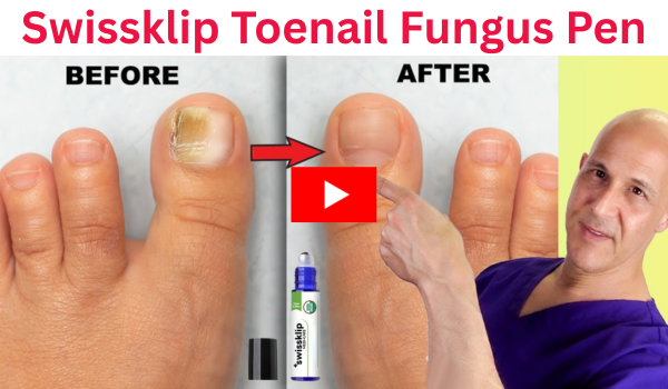 Swissklip Toenail Fungus Pen