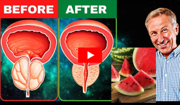 Watermelon Trick for Prostate.