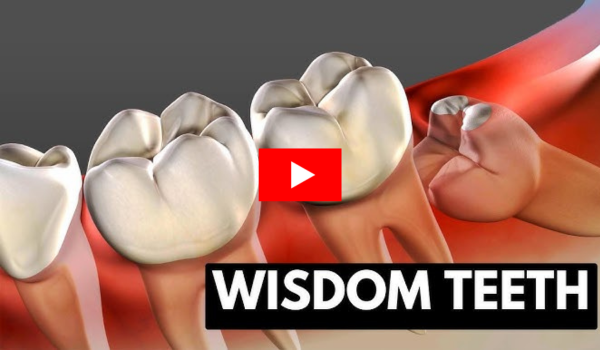 biblical cure for wisdom teeth