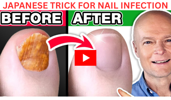 japanese trick for nail infection
