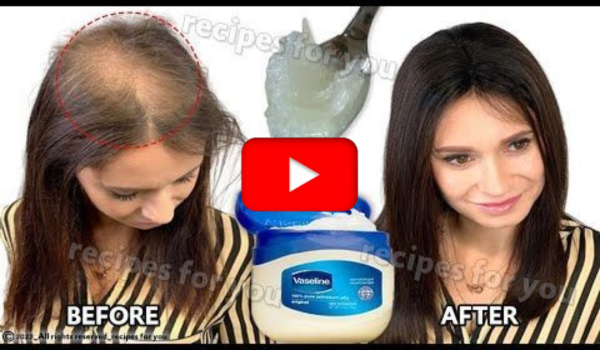 Baking Soda with Vaselin For Hair Growth