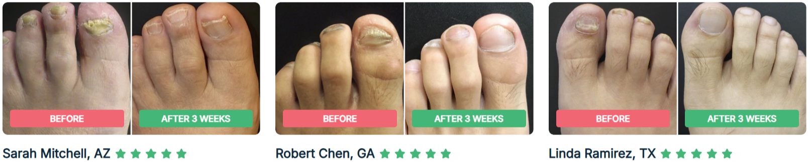 Dermafix Nail Fungus Treatment Gel Real results
