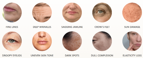 GloraMD Face Lift Serum Benefits