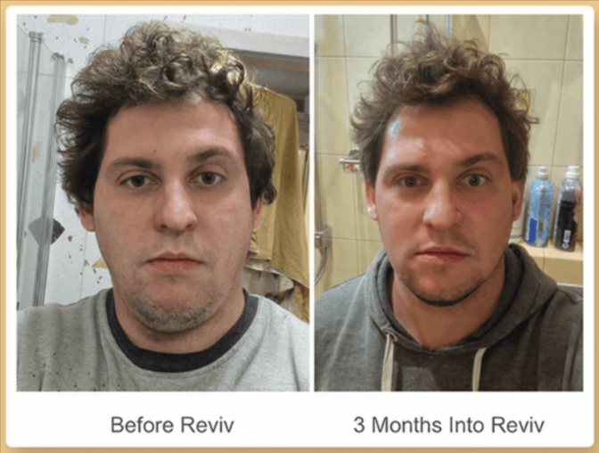 Reviv MouthGuard customer Reviews