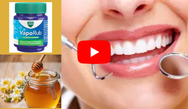 Vicks Vapor Rub And Honey For Oral Health
