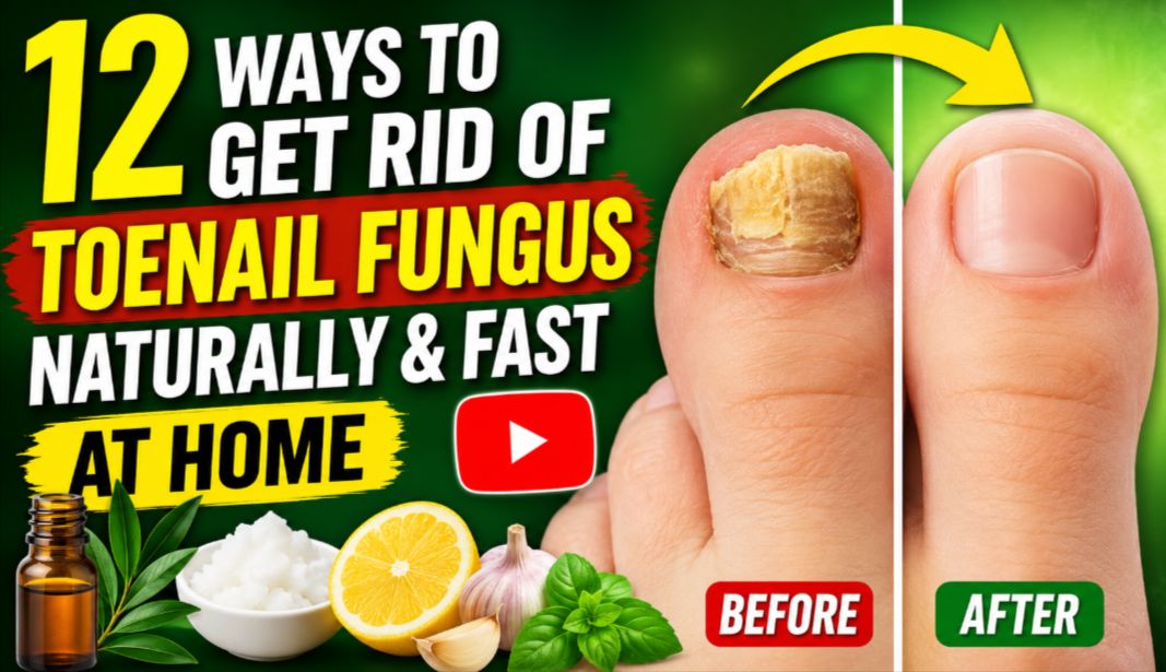 12 Ways to Get Rid of Toenail Fungus Naturally & Fast at Home