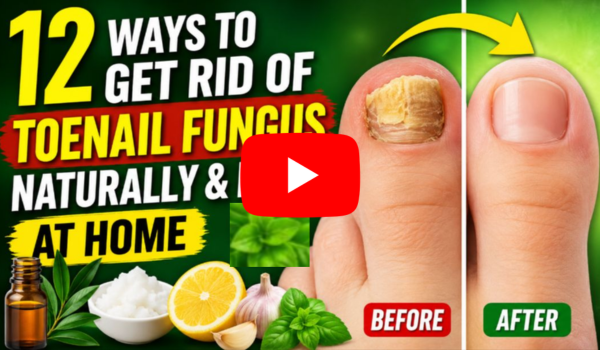 12 Ways to Get Rid of Toenail Fungus Naturally & Fast at Home
