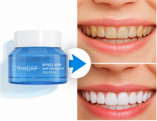 Bloom White Teeth Whitening benefites
