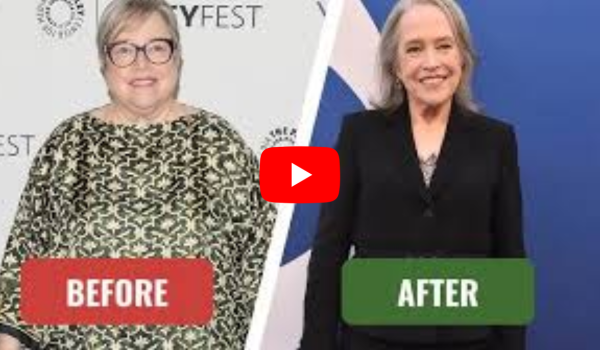 Kathy Bates Weight Loss
