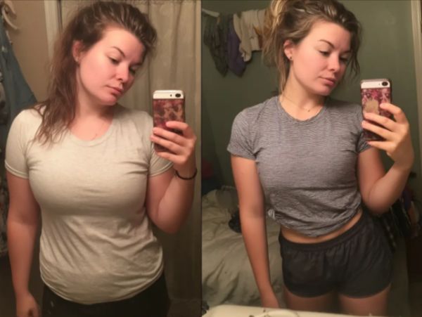 MEDVi Before and After