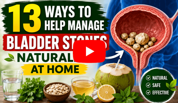 13 Ways to Help Manage Bladder Stones Naturally at Home