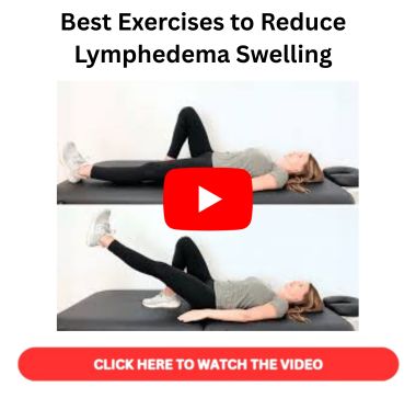 Best Exercise to Reduce Lymphedema Swelling