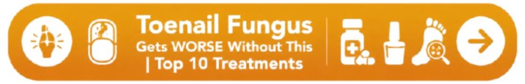 Toenail Fungus - Button