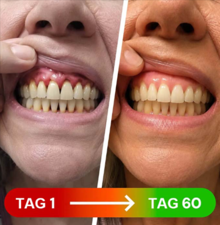 Bienfaits - Toothcare Red Light Gum Device