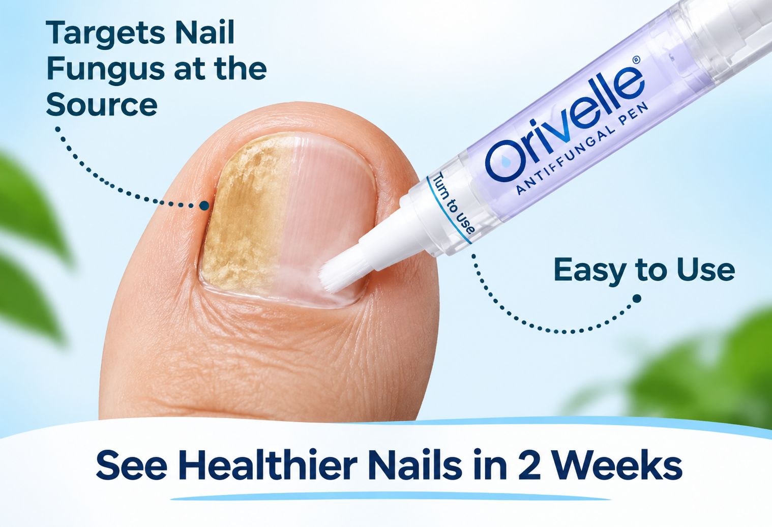 Orivelle Antifungal Pen - use1