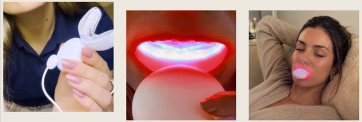 Toothcare Red Light Gum Device How to Use