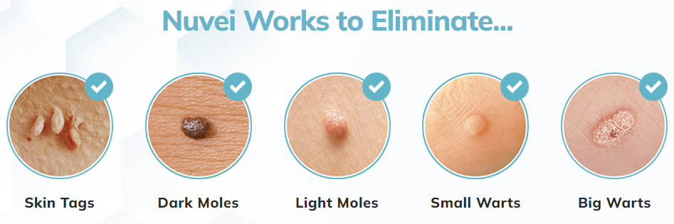 Nuvei Skin Tag Remover Benefits