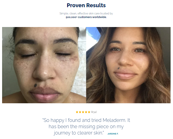 Civant Meladerm Customer Reviews