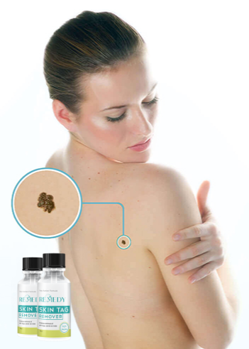 Remedy Skin Tag Remover Benefits