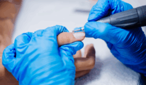 Lunavia Toenail Fungus Pen – Effective & Easy Fungus Treatment