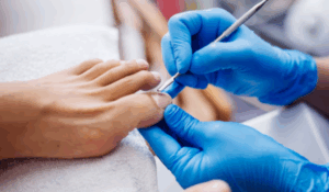 Lunavia Toenail Fungus Pen – Effective & Easy Fungus Treatment